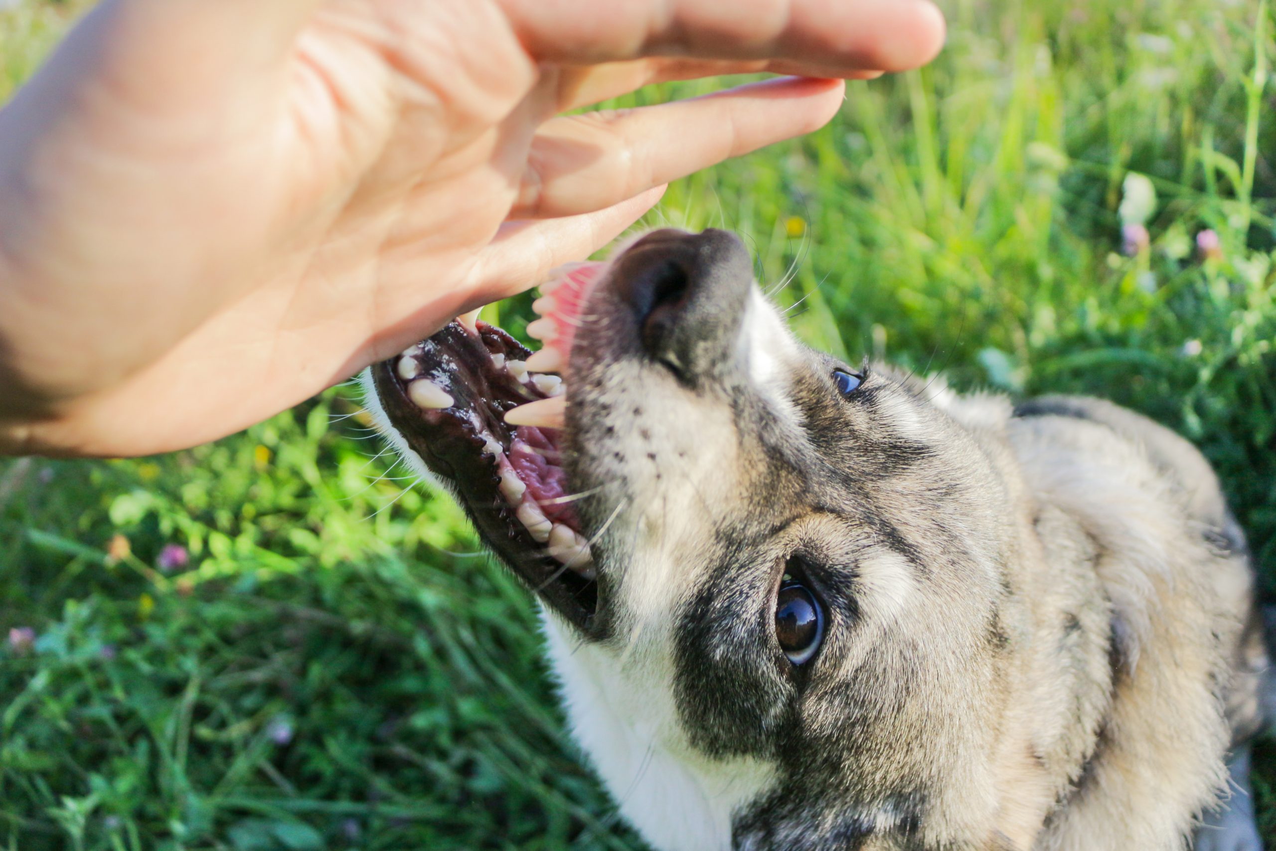 Fort Worth Dog Bite Lawyers | Free Consultation